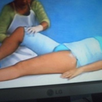 gessoterapia 