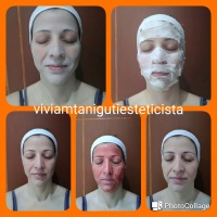 Limpeza de pele com hidratação, com produtos de qualidade e alta tecnologia.