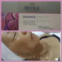Rejuvenescimento, com produtos de qualidade e alta tecnologia.