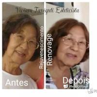 Rejuvenescimento, com produtos de qualidade e alta tecnologia.